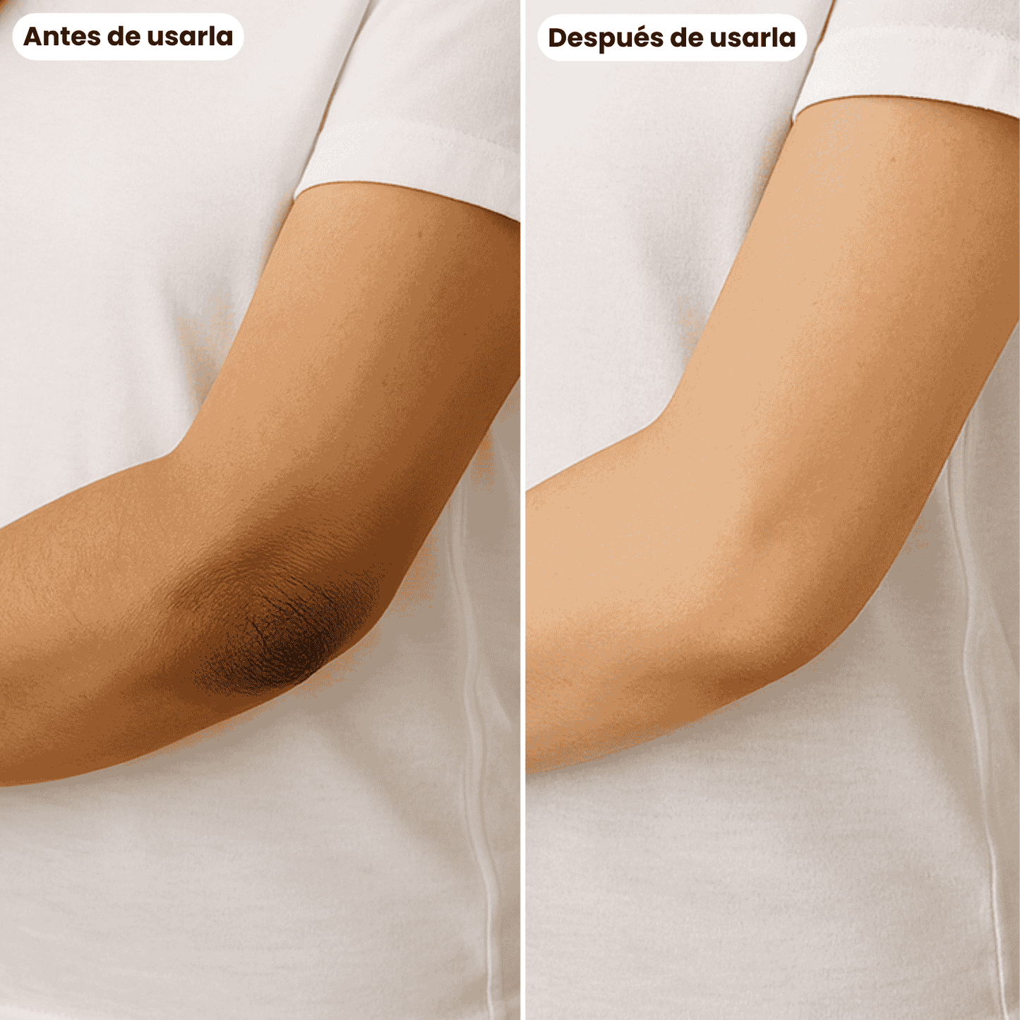 Codos Perfectos: Crema Renovadora Intensiva