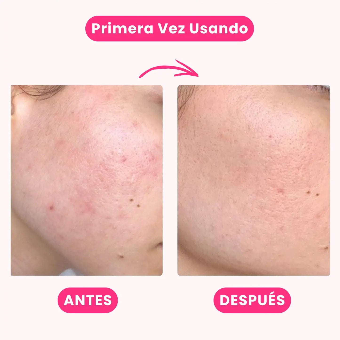 Pure Clay Mask: Mascarilla Limpieza Profunda