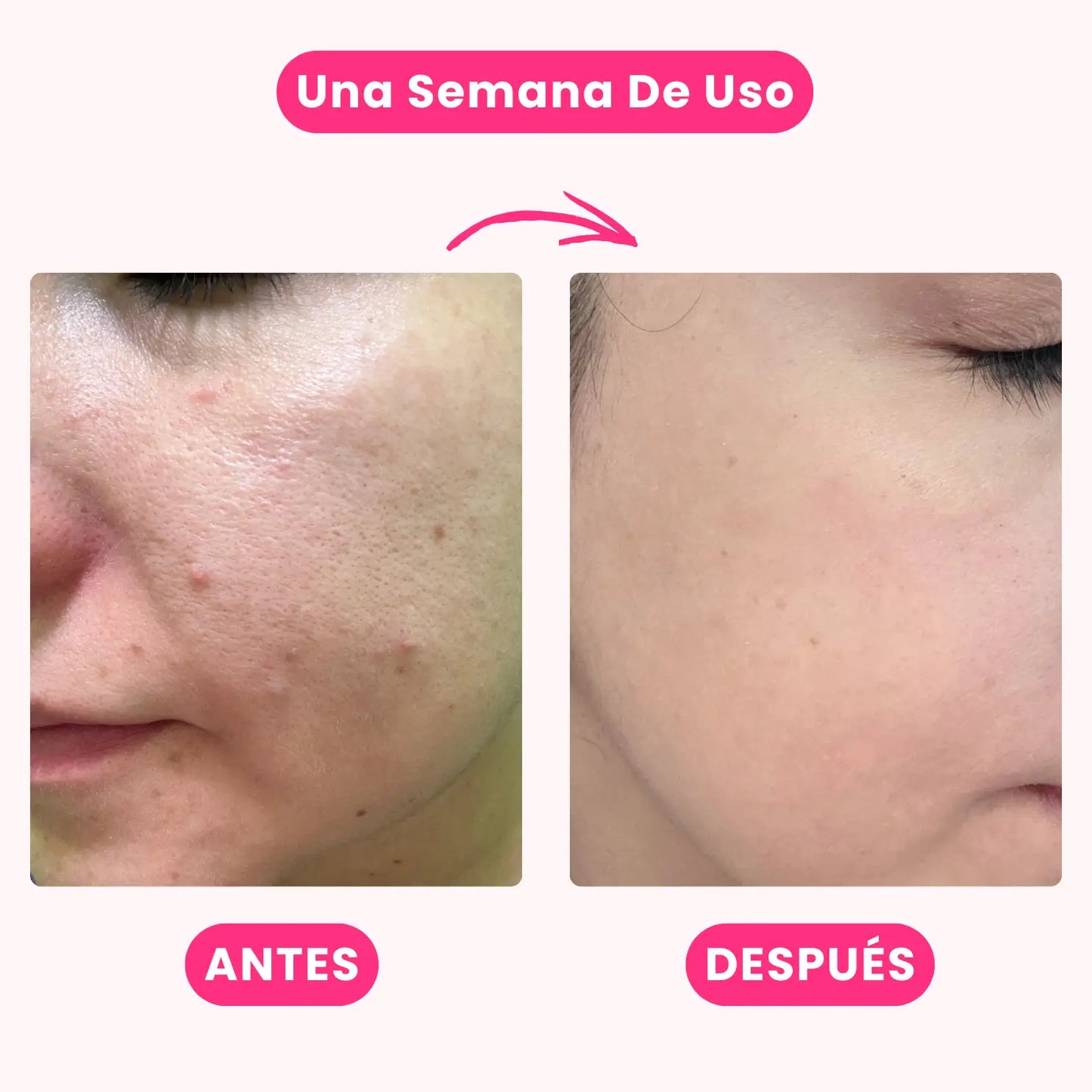 Pure Clay Mask: Mascarilla Limpieza Profunda