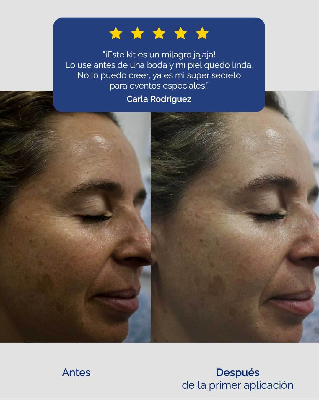 SUERO PROTECTOR Suero facial con Ácido Ferúlico