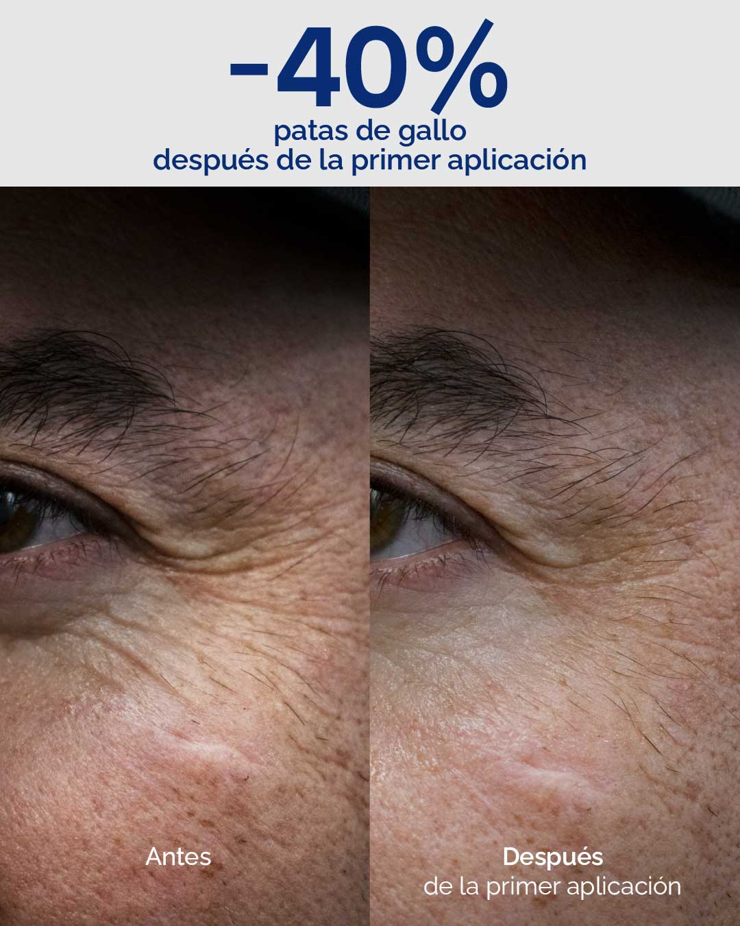 KIT BOTOX EFFECT