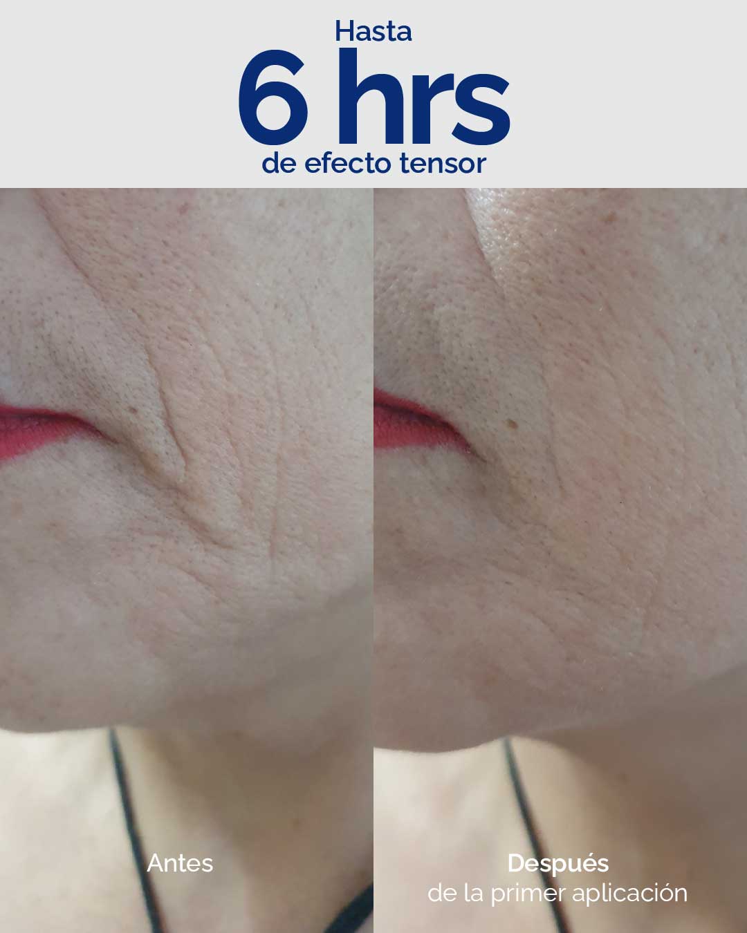KIT BOTOX EFFECT