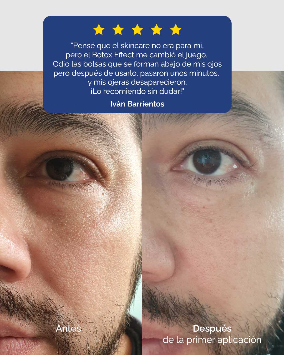KIT BOTOX EFFECT