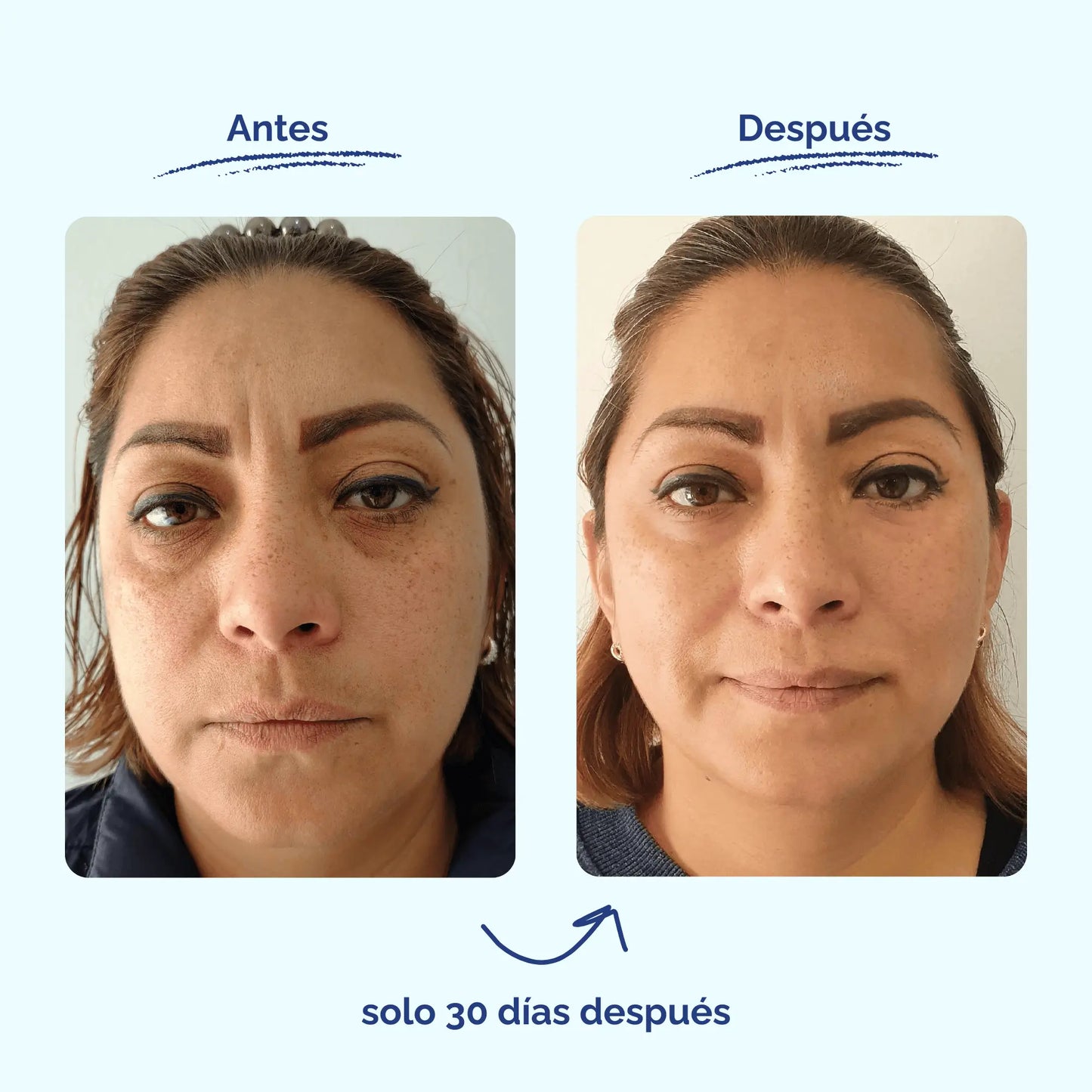 Suero Antiedad De Alga Suiza Y MSM - Elimina Líneas de Expresión y Consigue una Piel Más Joven En 21 Días