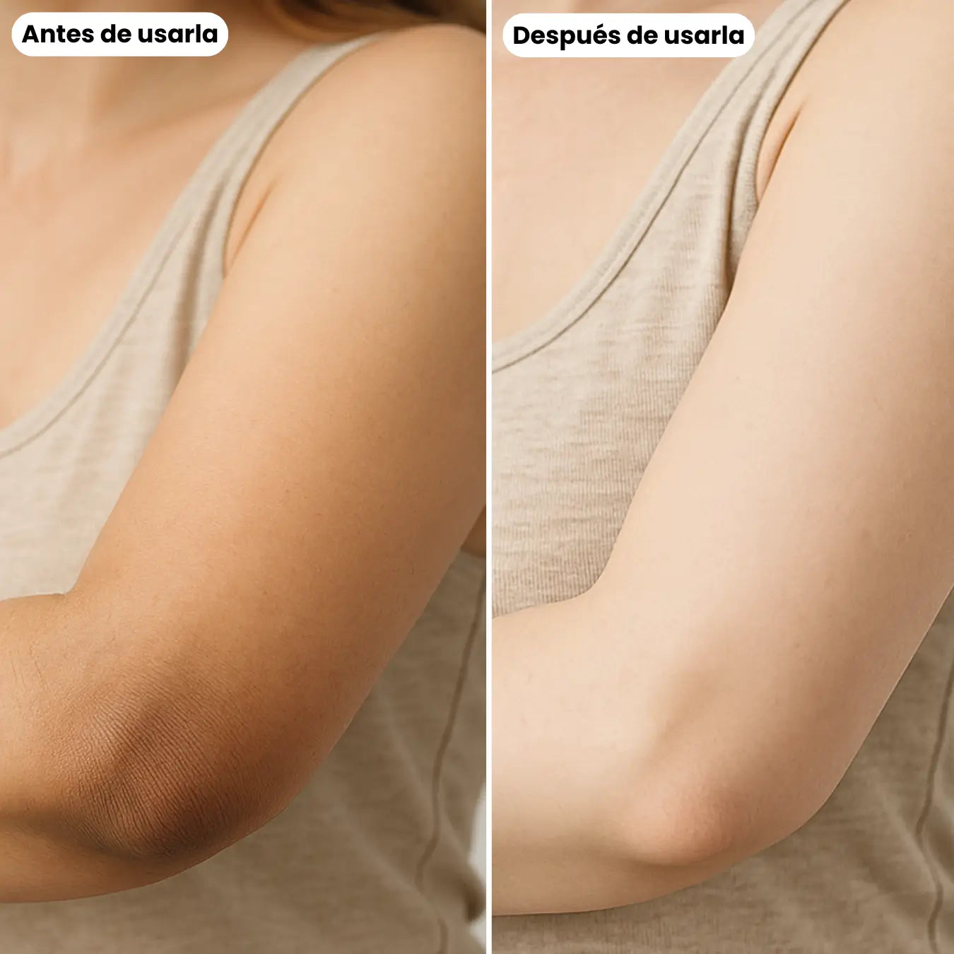 Codos Perfectos: Crema Renovadora Intensiva