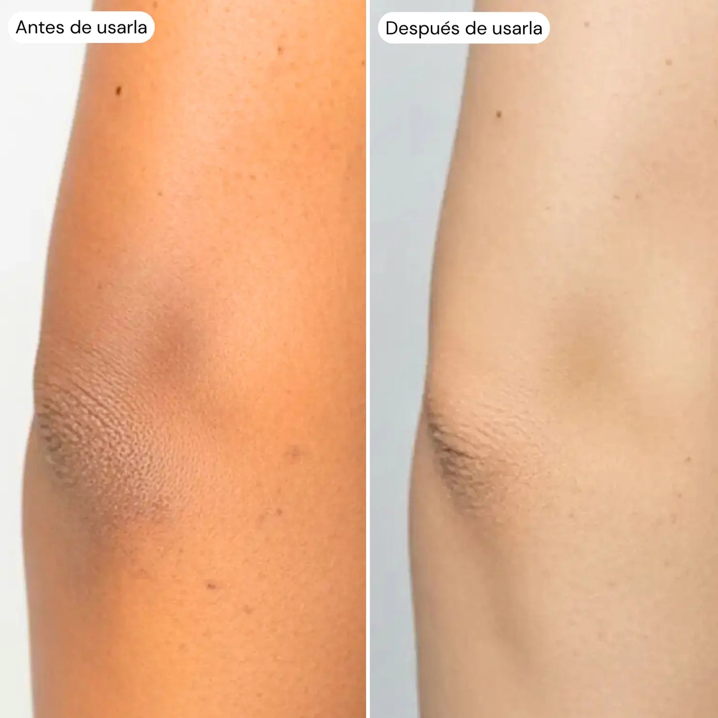 Codos Perfectos: Crema Renovadora Intensiva