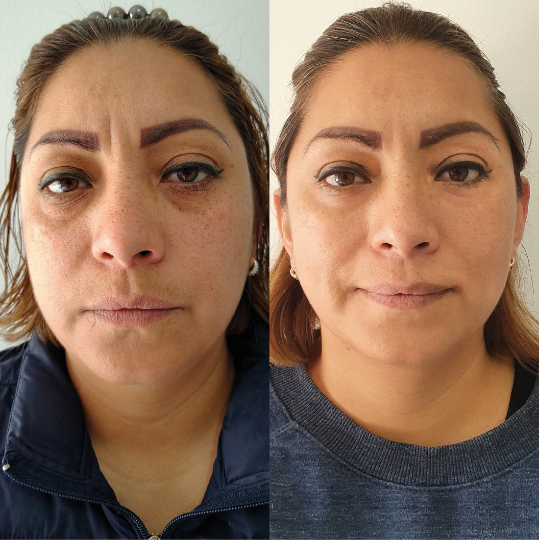 Ciencia detrás de la Longevidad de la Piel - KareCo Derm