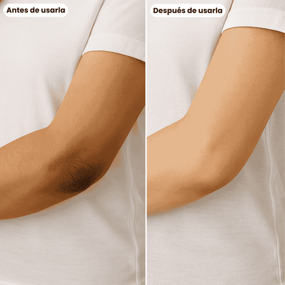 Codos Perfectos: Crema Renovadora Intensiva