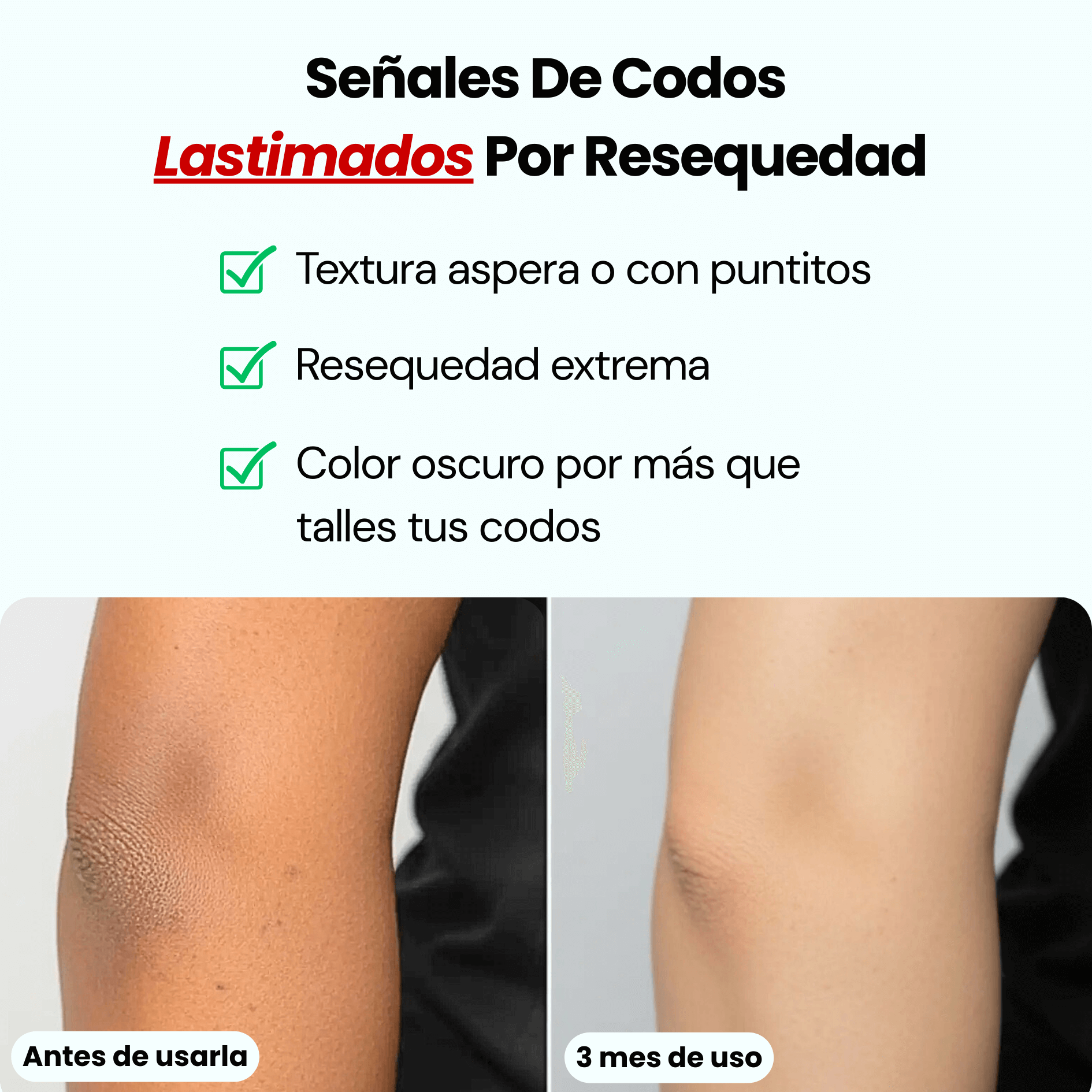 Codos Perfectos: Crema Renovadora Intensiva