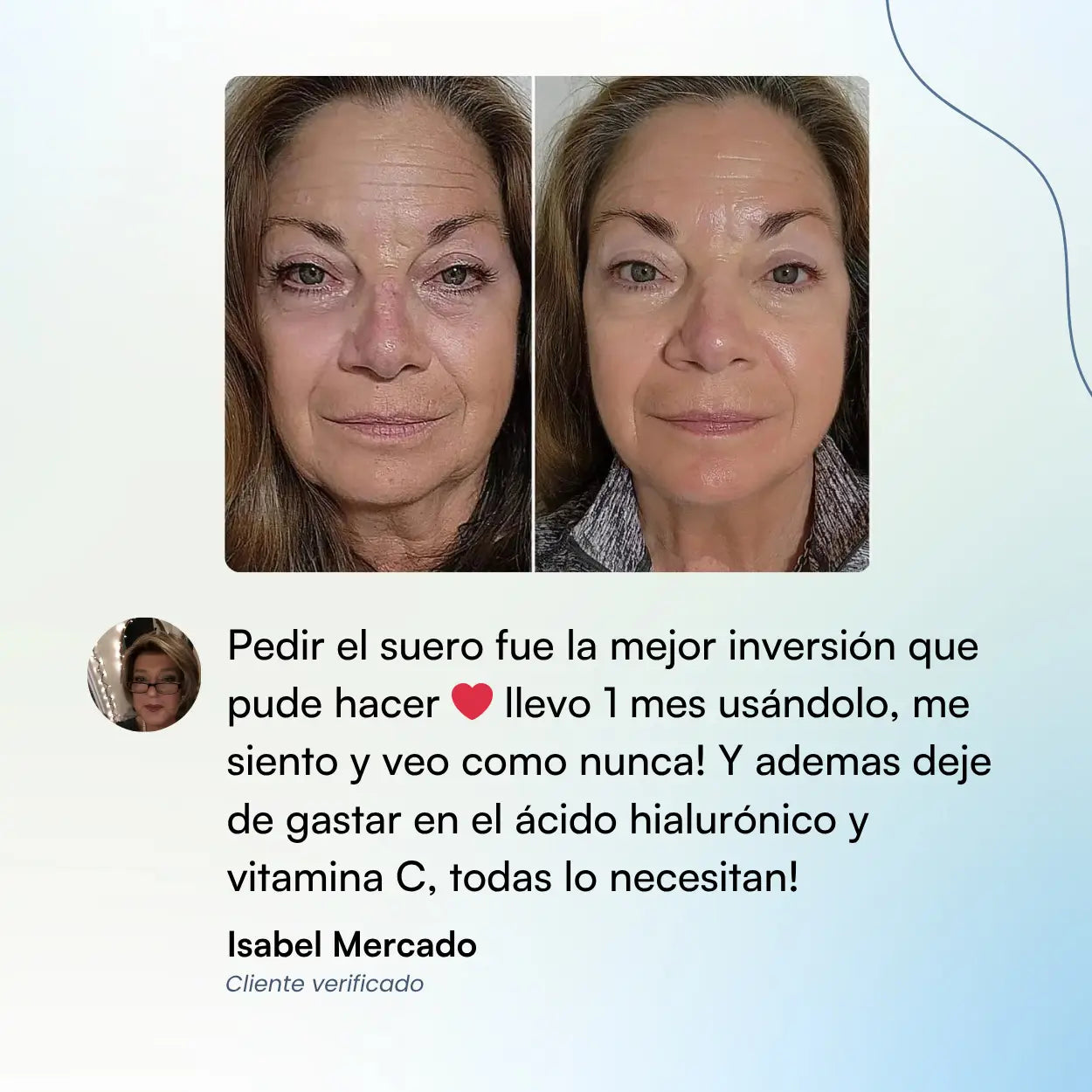 Suero Antiedad De Alga Suiza Y MSM - Elimina Líneas de Expresión y Consigue una Piel Más Joven En 21 Días