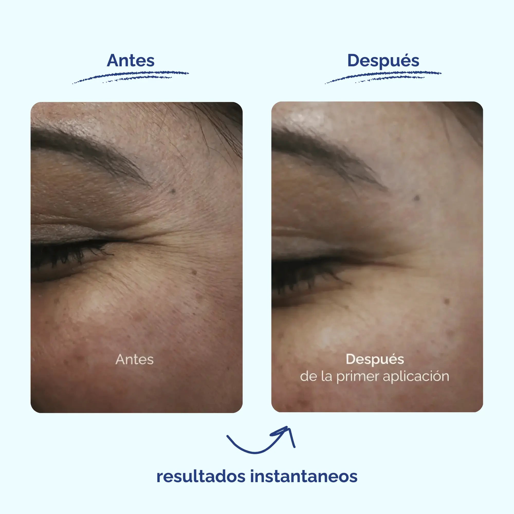 Longevity Serum - Suero Antiedad con Alga Suiza + MSM - Hidratación Profunda/ Protección Diaria