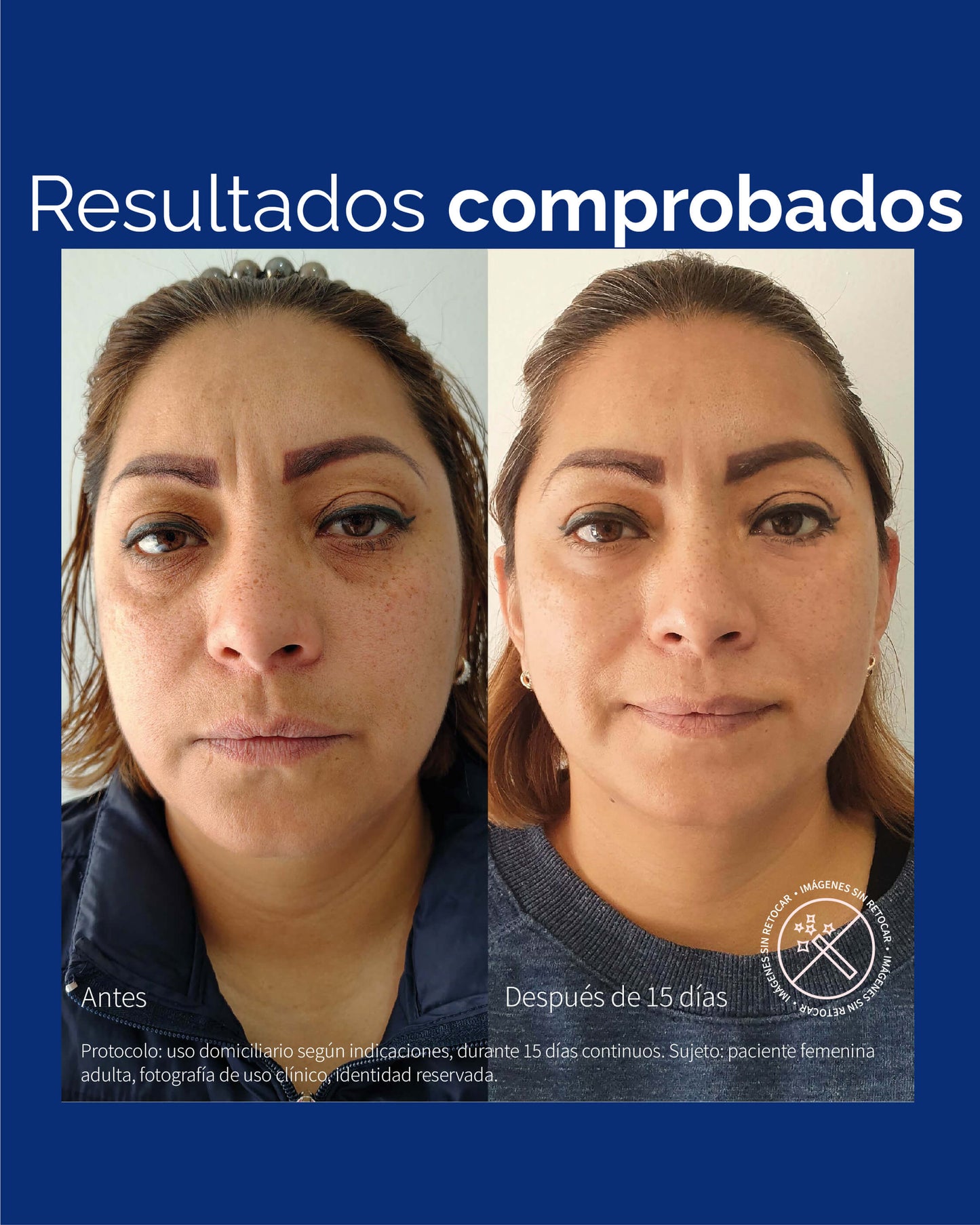 CE Defense Serum - KareCo Derm