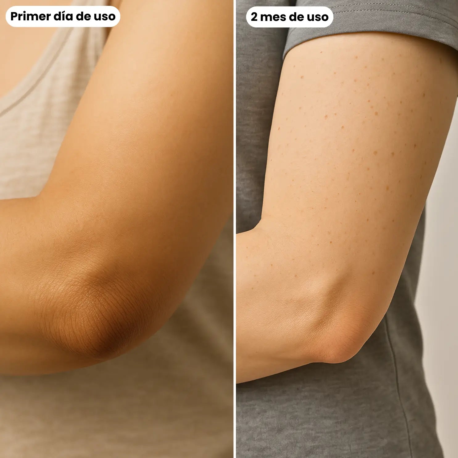 Codos Perfectos: Crema Renovadora Intensiva