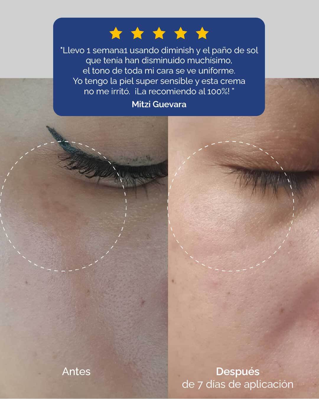 Diminish Cream: Crema Facial Anti Manchas - KareCo Derm