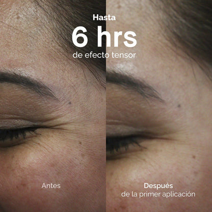 Less Lines: Roll On Anti Arrugas - KareCo Derm