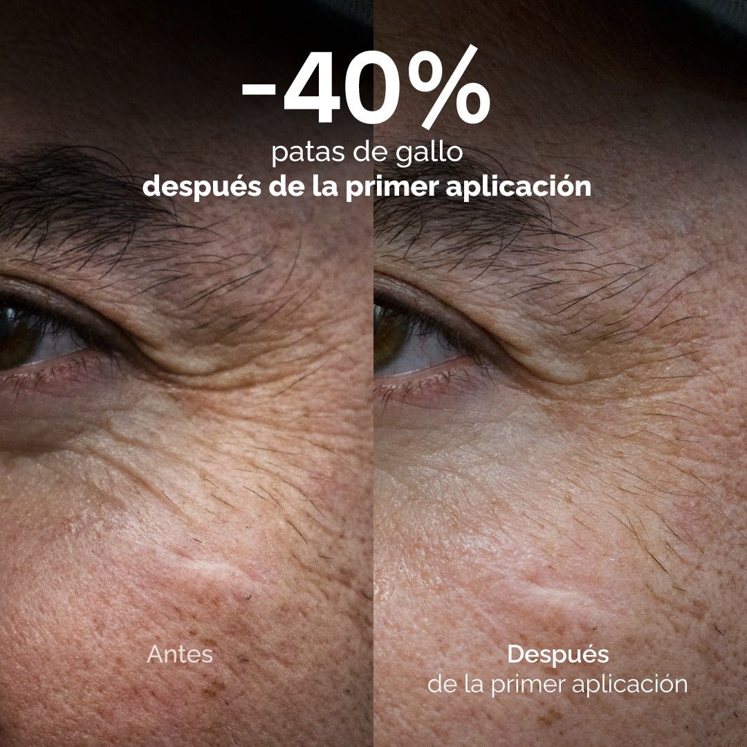 Less Lines: Roll On Anti Arrugas - KareCo Derm