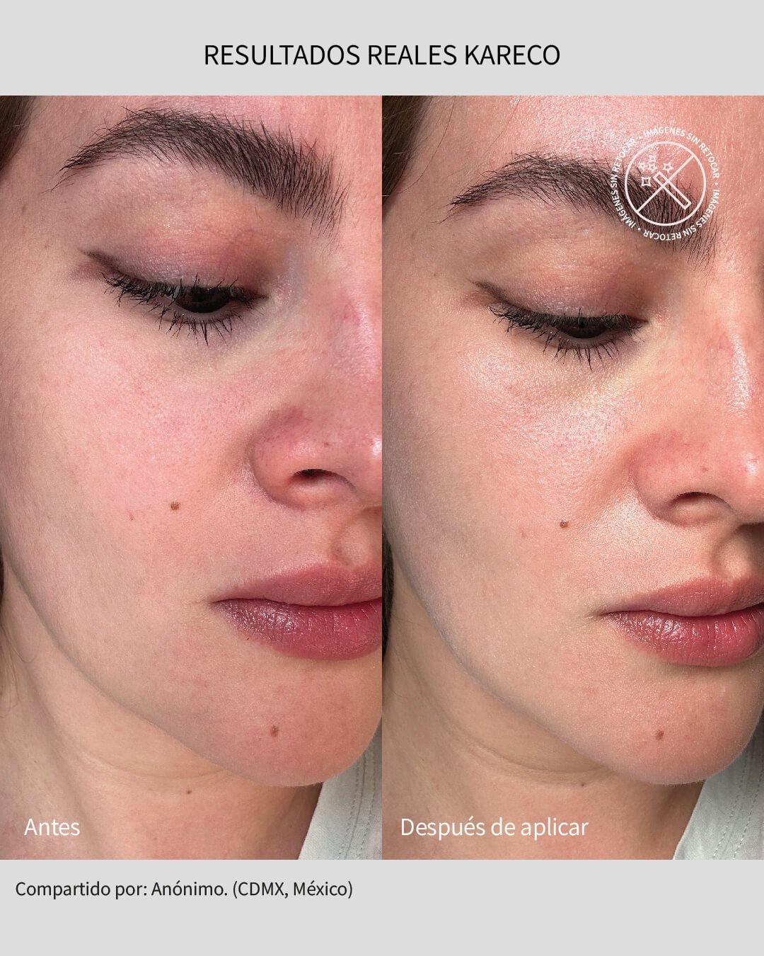 Sunkare Mineral & Organic: Protector Solar FPS 50+ - KareCo Derm