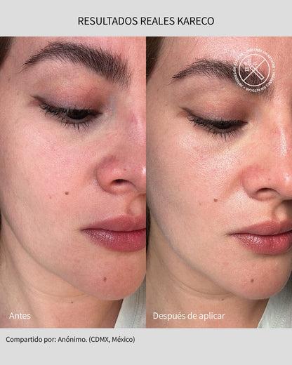 Sunkare Mineral & Organic: Protector Solar FPS 50+ - KareCo Derm