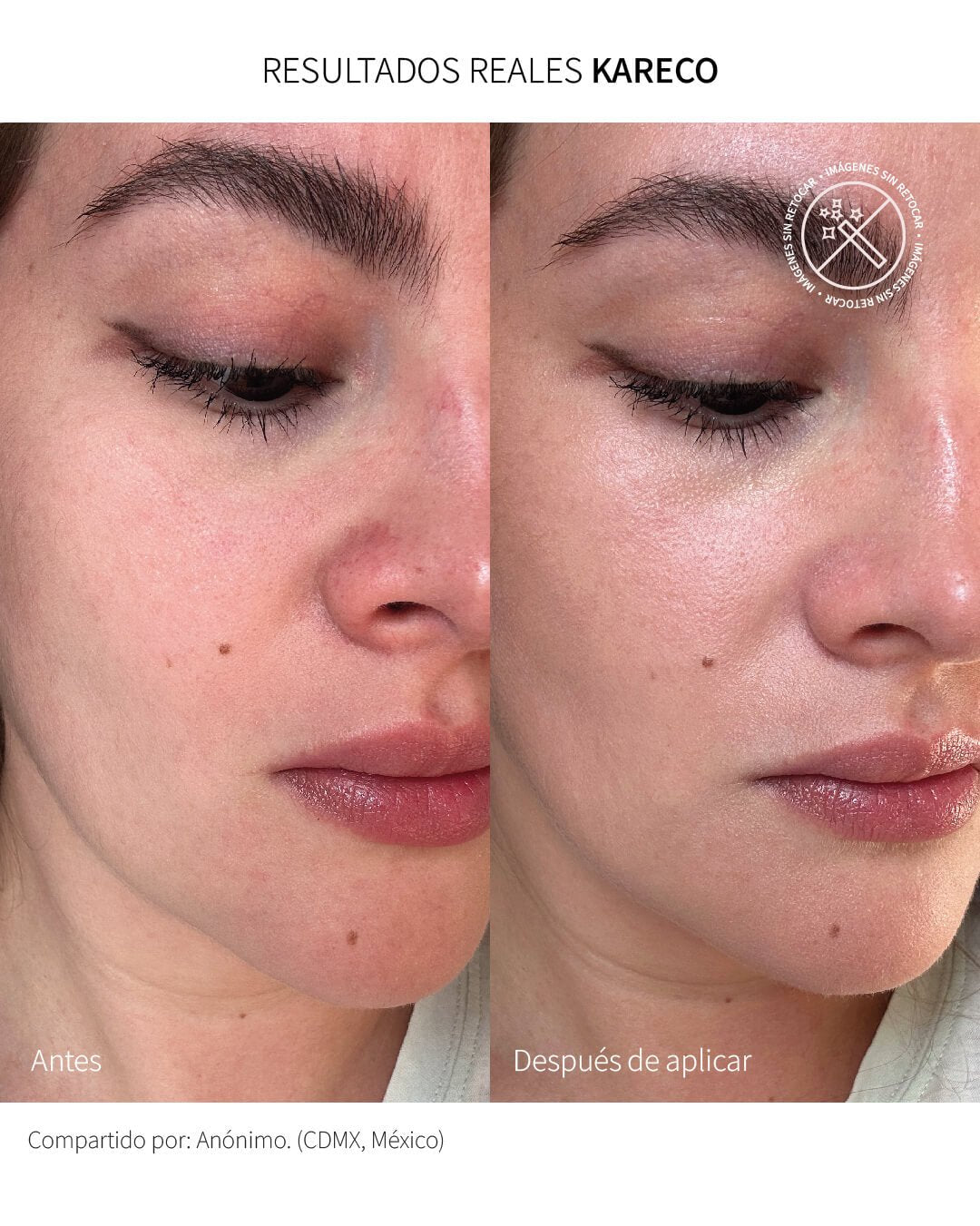 Sunkare Mineral Touch Of Color: Protector solar facial unificador FPS 50+ - KareCo Derm
