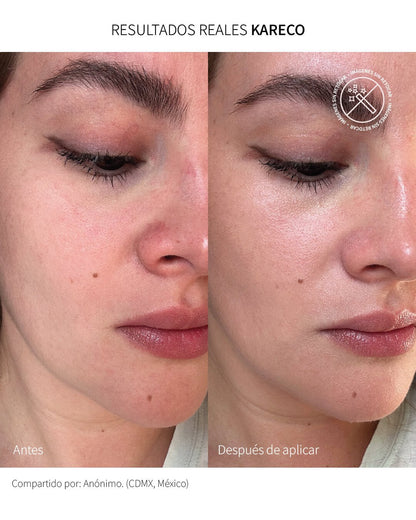 Sunkare Mineral Touch Of Color: Protector solar facial unificador FPS 50+ - KareCo Derm